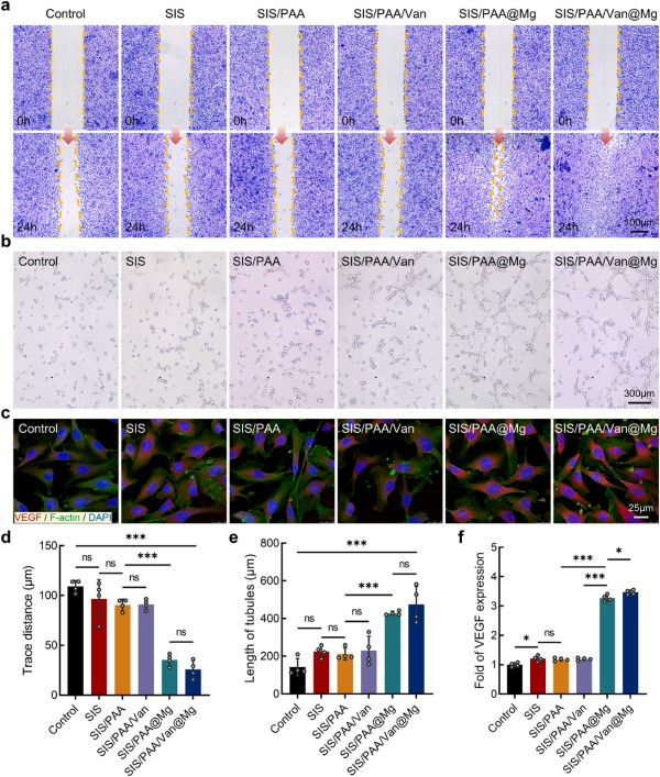 1764119524149795.jpg 图片4-血管生成.jpg
