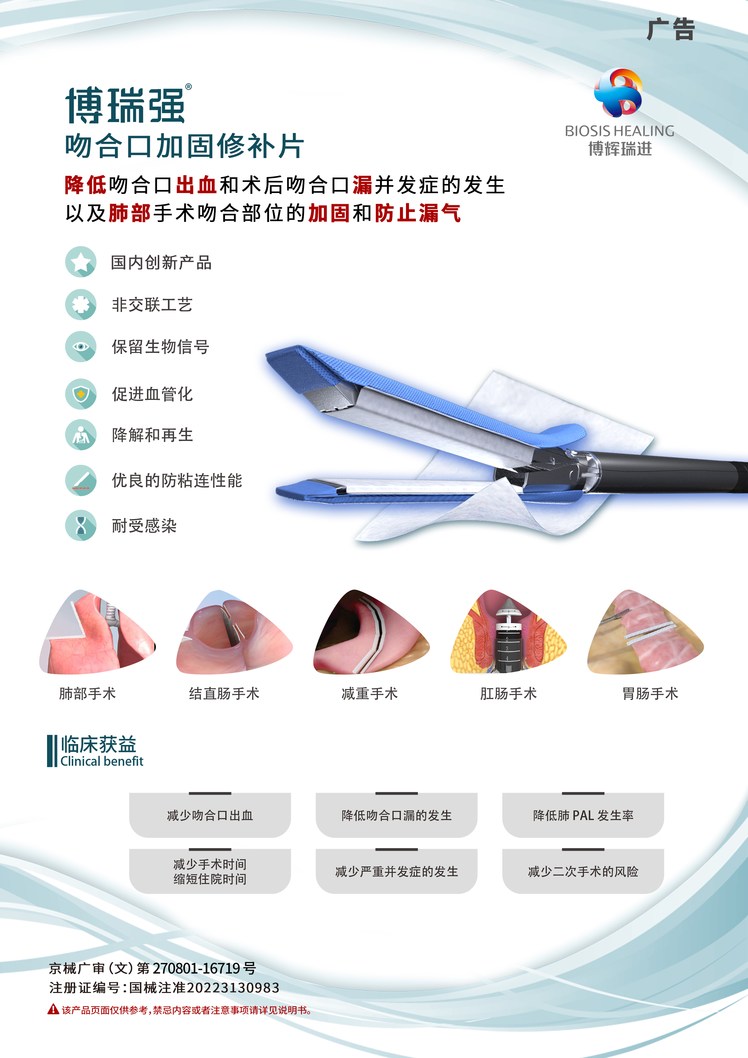 吻合口加固修补片.jpg